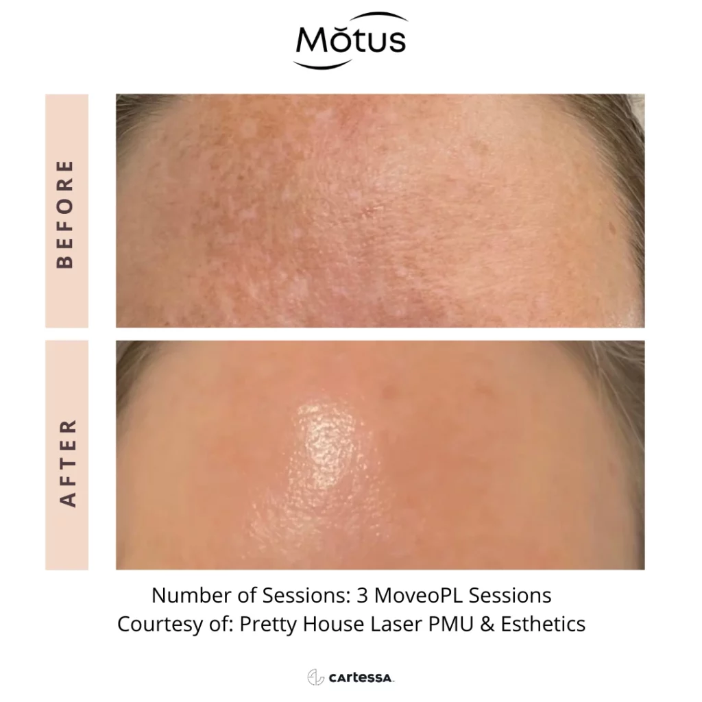 Motus10168970869491