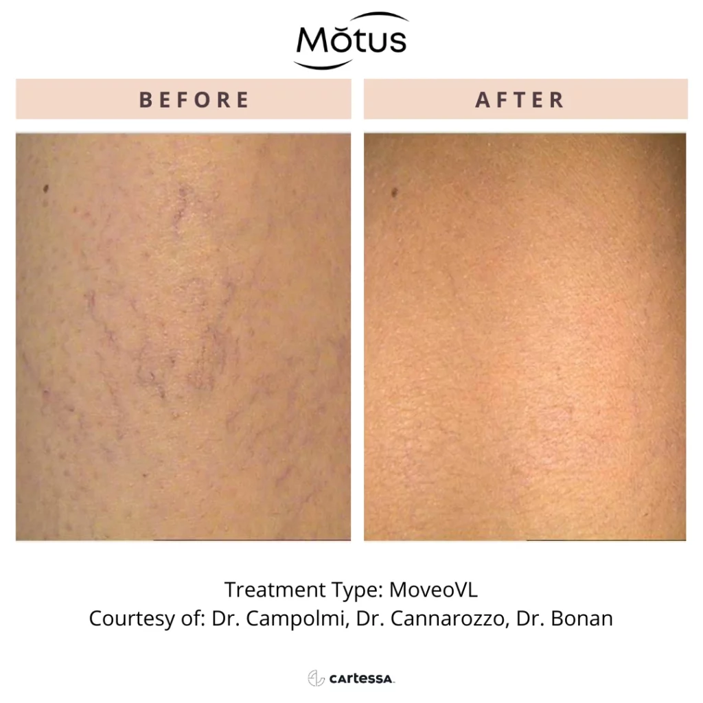 Motus3168970869123