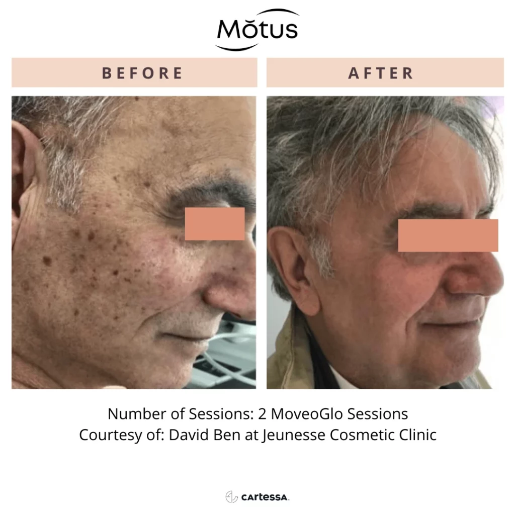 MotusAZ5168970930598